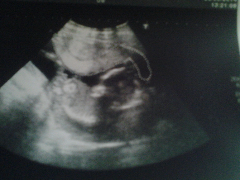 Кому тоже не терпится узнать пол?