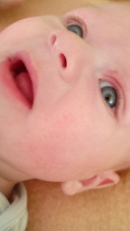 Аллергия или нет?