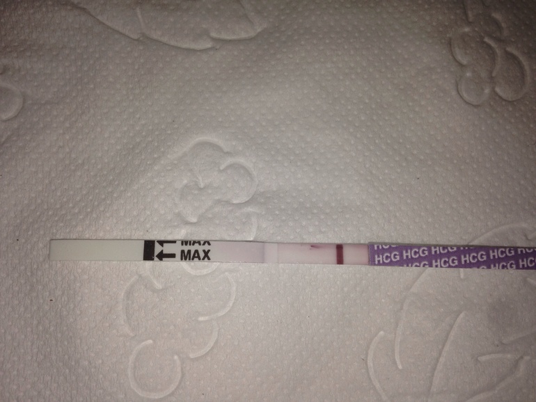 Посмотрите, девочки!!! Это глюк мой?