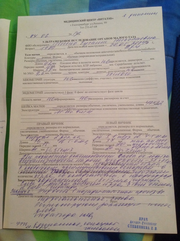 Кщ,бм кисты, много слов 1 фотка (мои успехи )