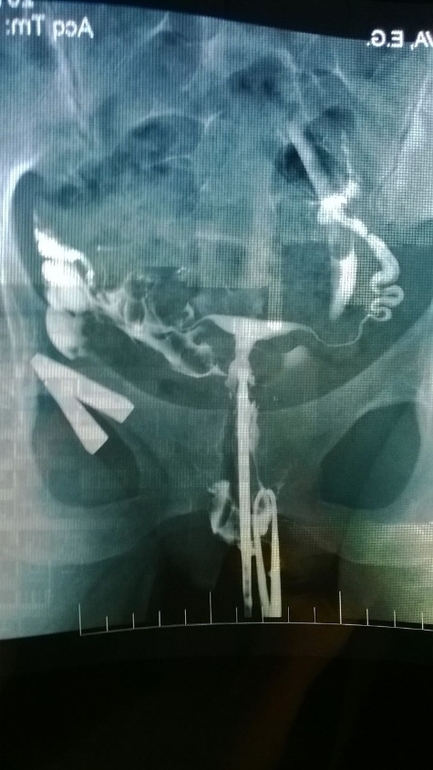 Посмотрите мой снимок ГСГ , плиизз!