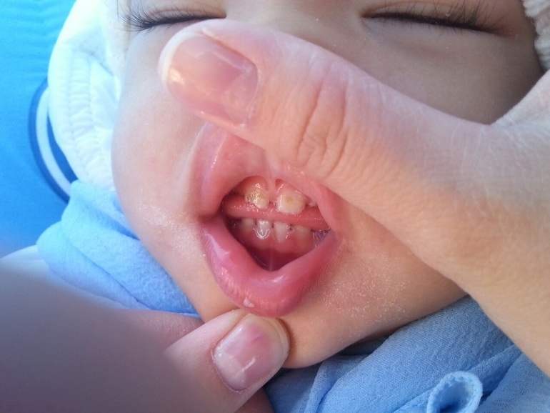 Нуждаемся в совете!!!