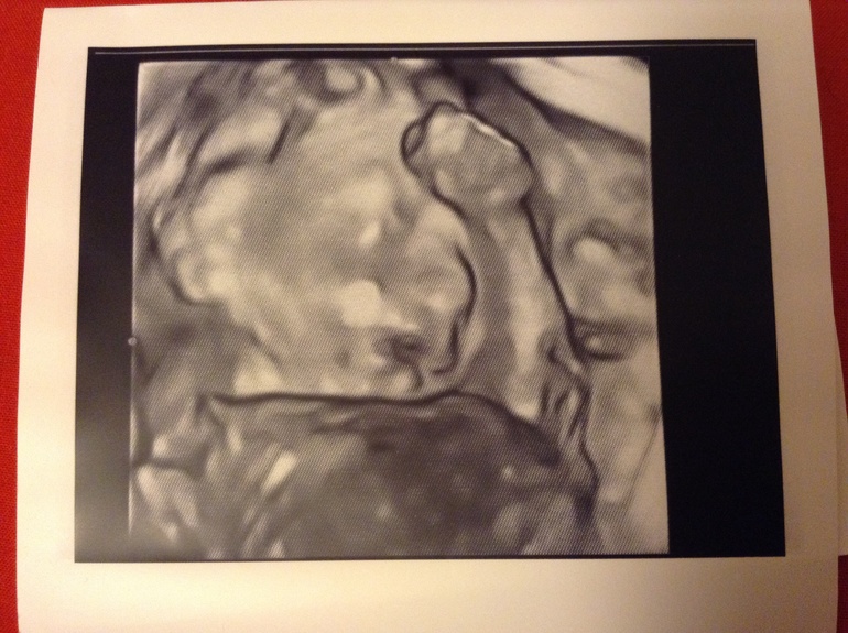 Максимке 22 недельки!