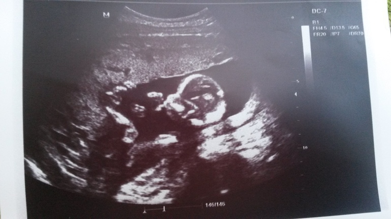 Наша первая фотография)))