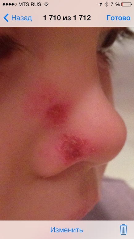 Подскажите, что может быть?