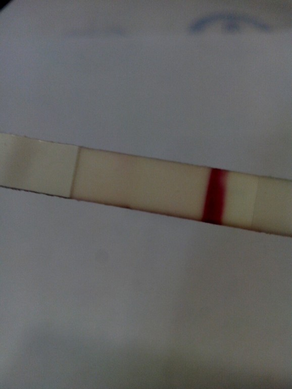 ББ тест..............