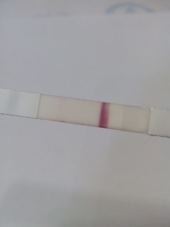 ББ тест..............