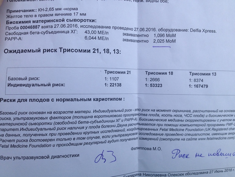 21 нормально. 1 Скрининг трисомия 21 нормальные показатели. Норма 21 хромосоме трисомия. Трисомия показатели нормы 13 недель. Нормальные показатели при беременности трисомии 21.