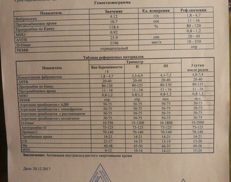  Foto 47