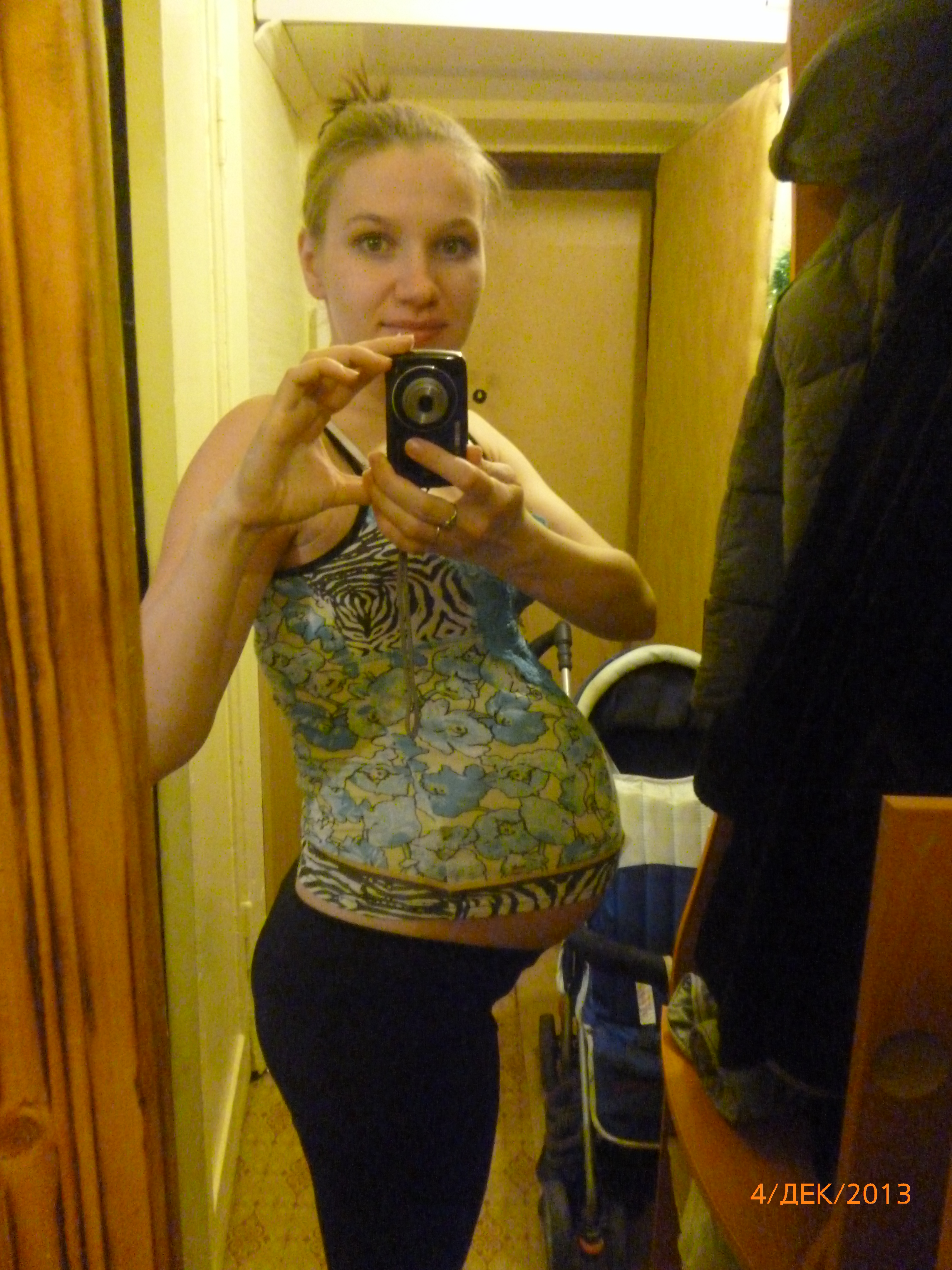 вторая беременность и роды