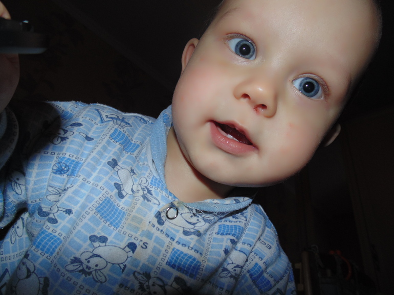 а мы прошли мед осмотр к годику