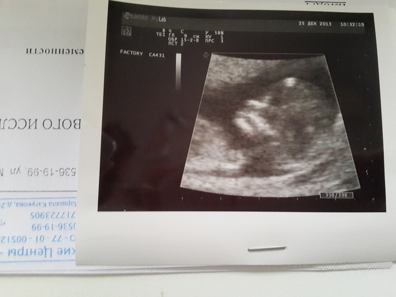 1 ый скрининг