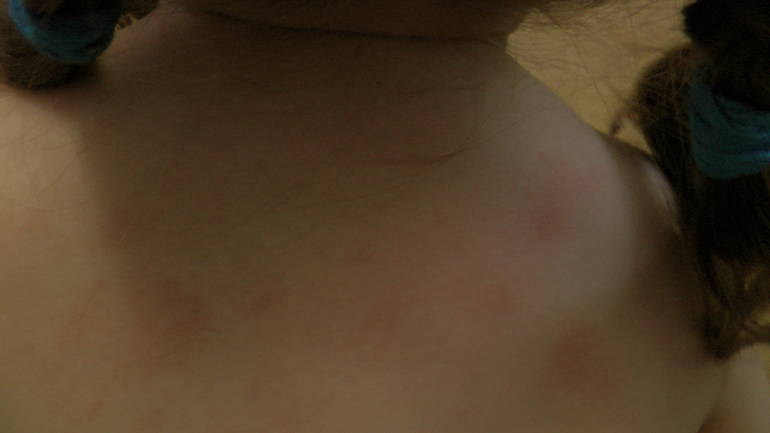 Пятна. нужен совет