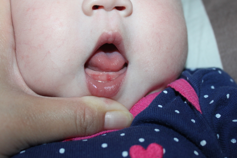 А у нас первый зуб!