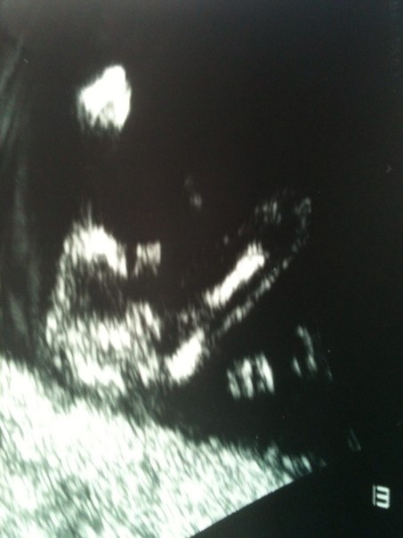 Про себя и про узи)