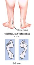 Формы ног и свод стоп ребенка
