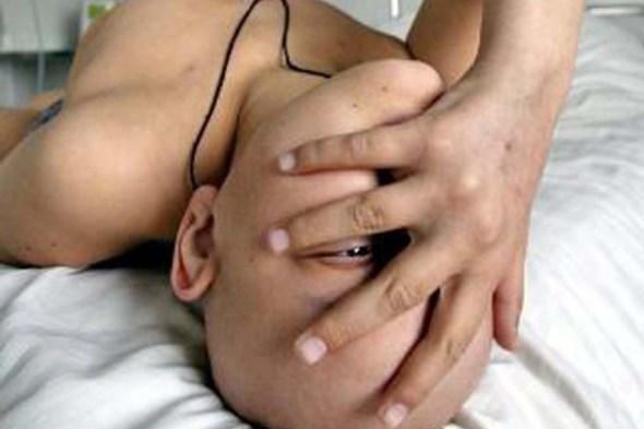 РАК - ХОЧУ ПРЕДУПРЕДИТЬ...