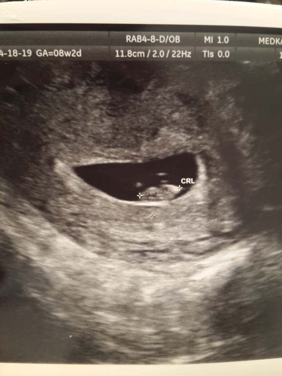 второе узи)))))