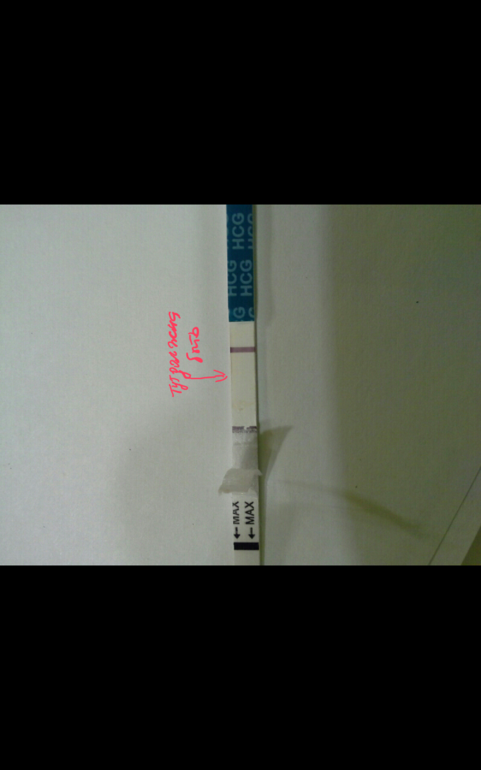 Может ли быть это Б?или это бракованный тест(((