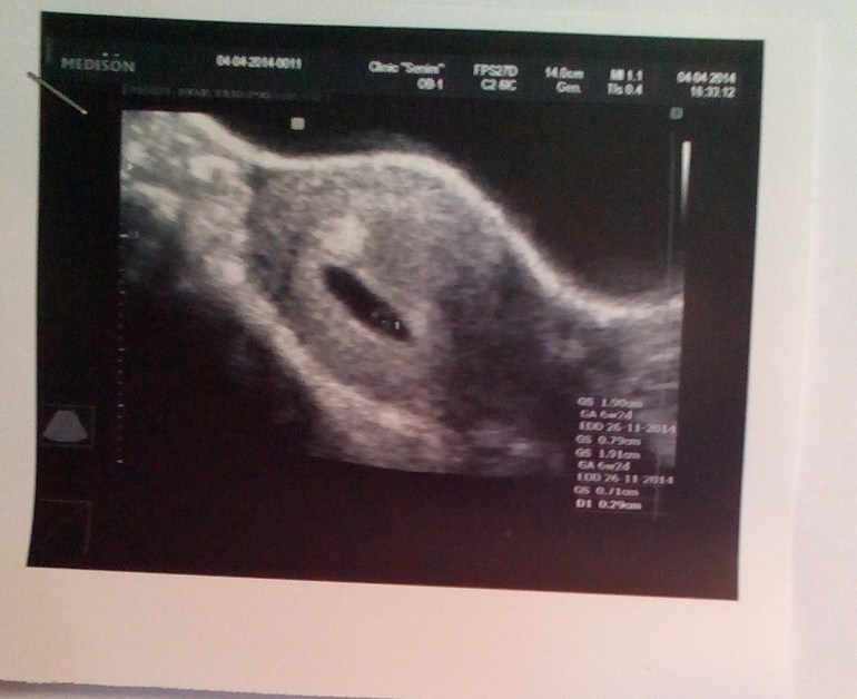 Маленький,но ЕСТЬ.....!!!!!!!!!