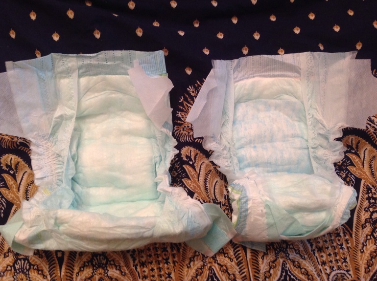 Аллергия на памперсы???