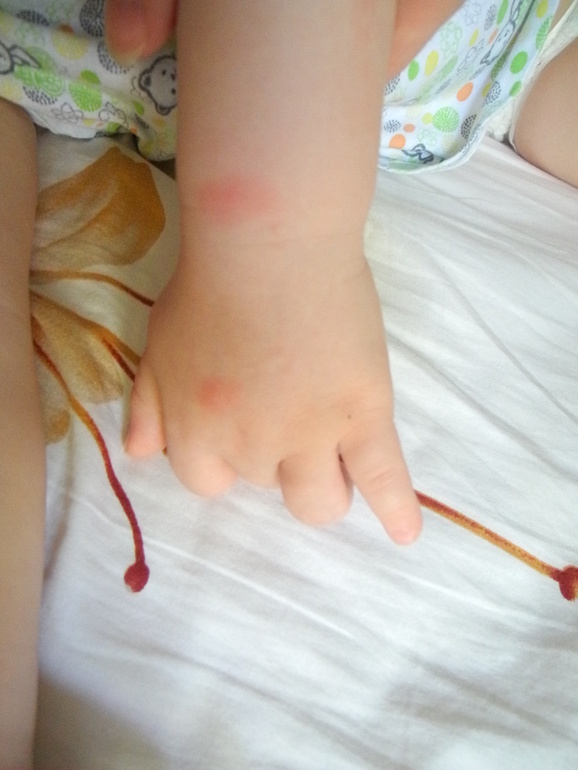 Комары или нет?