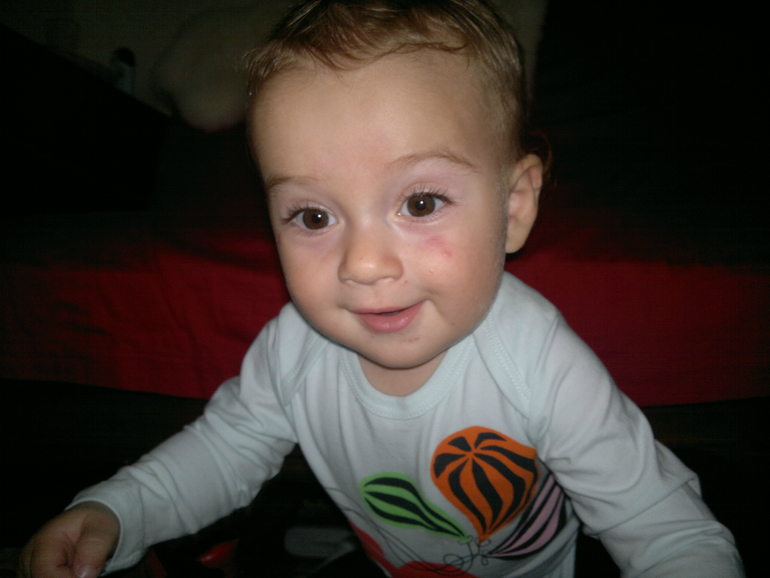 Шкодит у бабушки) А щечки покусаны комариками ((