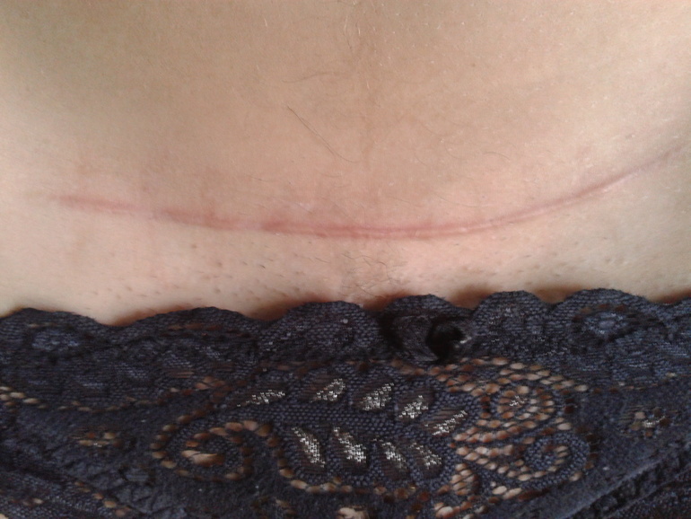 Спасибо тебе, о великий и могучий Контрактубекс!