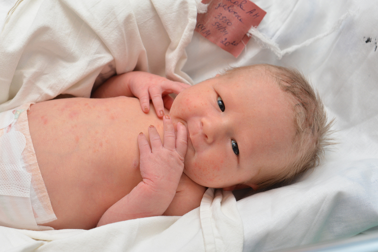 Наша выписка 7.04.2014 года.