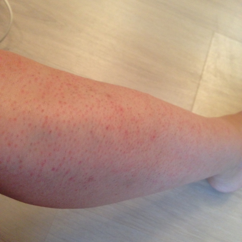 Эпиляция и женский цикл