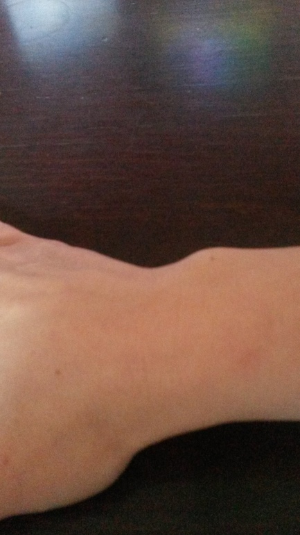 суставы на запястьях