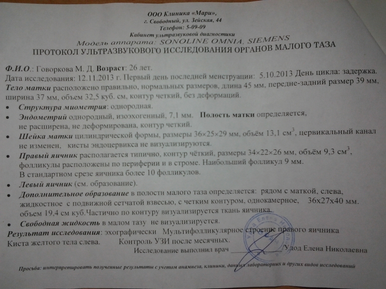 УЗИ