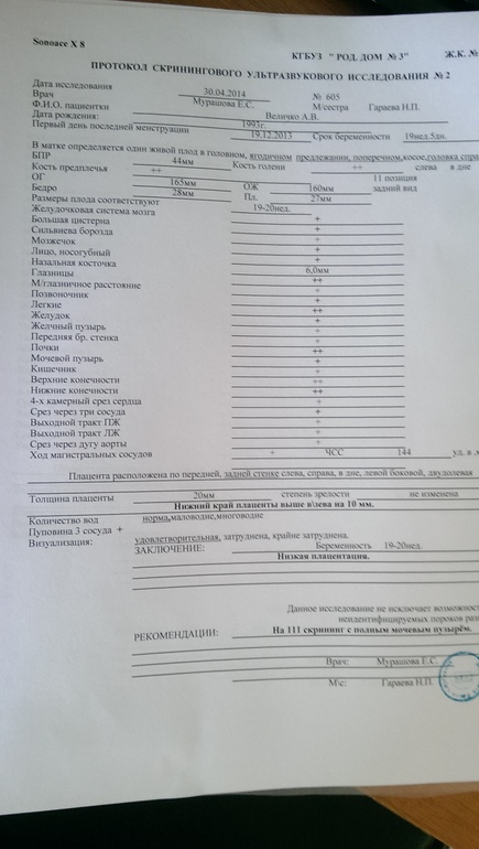 УЗИ